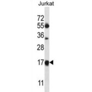 Mitochondrial Ribosomal Protein L41 (MRPL41) Antibody