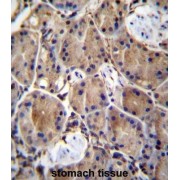 LIM Domain-Containing Protein 1 (LIMD1) Antibody