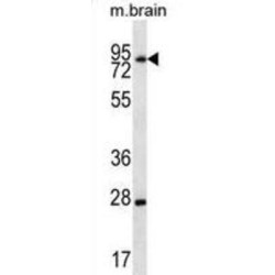 LIM Domain-Containing Protein 1 (LIMD1) Antibody