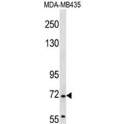 Grainyhead-Like Protein 2 Homolog (GRHL2) Antibody