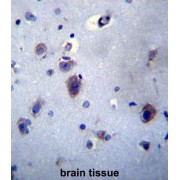 Prolactin-Releasing Peptide (PRLH) Antibody