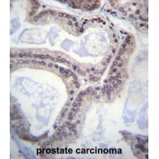 Eukaryotic Translation Initiation Factor 1A, Y-Chromosomal (EIF1AY) Antibody