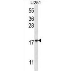 Eukaryotic Translation Initiation Factor 1A, Y-Chromosomal (EIF1AY) Antibody