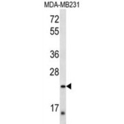 Peroxisomal Membrane Protein 11A (PEX11A) Antibody