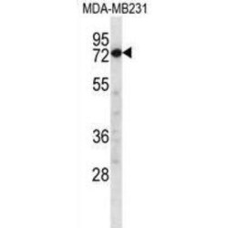 Calpain-8 (CAPN8) Antibody