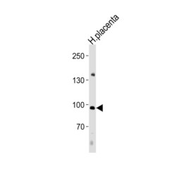 Nuclear Factor of Activated T Cells 4 (NFATC4) Antibody