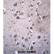 Integral Membrane Protein 2B (ITM2B) Antibody