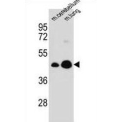 Integral Membrane Protein 2B (ITM2B) Antibody