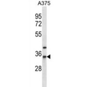 Arylamine N-Acetyltransferase 1 (NAT1) Antibody