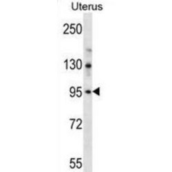 Leucine-Rich Repeat-Containing Protein 37B (LRRC37B) Antibody