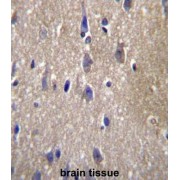 Carboxypeptidase N2 (CPN2) Antibody