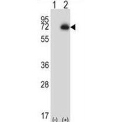 Carboxypeptidase N2 (CPN2) Antibody