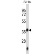 Deoxynucleotidyltransferase Terminal-Interacting Protein 1 (DNTTIP1) Antibody