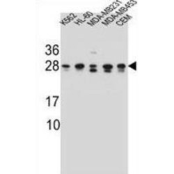 RAB3D, Member RAS Oncogene Family (RAB3D) Antibody