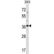 Ankyrin Repeat Domain-Containing Protein 60 (ANKRD60) Antibody