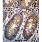 N-Acetylserotonin O-Methyltransferase-Like Protein (ASMTL) Antibody