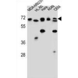 N-Acetylserotonin O-Methyltransferase-Like Protein (ASMTL) Antibody