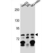 Zinc Finger Protein 555 (ZNF555) Antibody