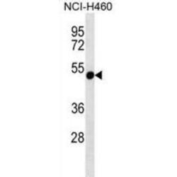 Rhabdoid Tumor Deletion Region Protein 1 (RTDR1) Antibody