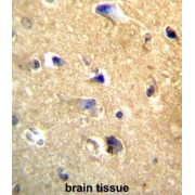 Cadherin 22 (CDH22) Antibody