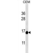 WB analysis of extracts of CEM cell line lysates (35 µg/lane), using ATAD4 Antibody.