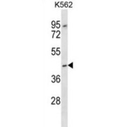 Olfactory Receptor Family 13 Subfamily F Member 1 (OR13F1) Antibody