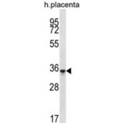 Olfactory Receptor 6K6 (OR6K6) Antibody