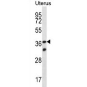 Olfactory Receptor 4X2 (OR4X2) Antibody