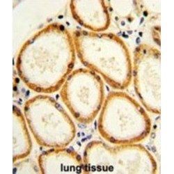 Caspase 2 (CASP2) Antibody