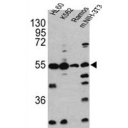 Caspase 2 (CASP2) Antibody