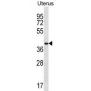 Olfactory Receptor 2V2 (OR2V2) Antibody