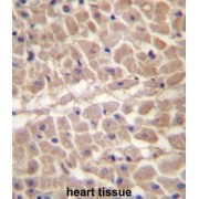 Tripartite Motif-Containing Protein 11 (TRIM11) Antibody