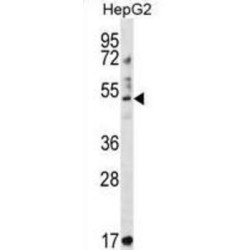 Tripartite Motif-Containing Protein 11 (TRIM11) Antibody