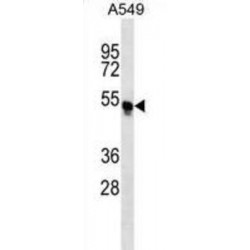 Tripartite Motif-Containing Protein 54 (TRIM54) Antibody
