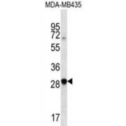 Chemokine C-X-C-Motif Receptor 6 (CXCR6) Antibody