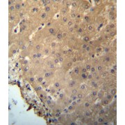 Charged Multivesicular Body Protein 2b (CHMP2B) Antibody