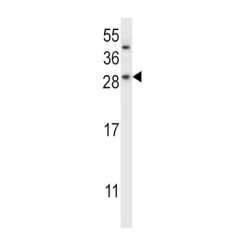 Charged Multivesicular Body Protein 2b (CHMP2B) Antibody