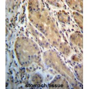 ERO1-Like (S. Cerevisiae) (ERO1L) Antibody