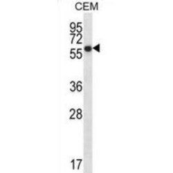 ERO1-Like (S. Cerevisiae) (ERO1L) Antibody