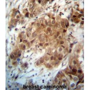 Forkhead Box Protein O3 (FOXO3) Antibody