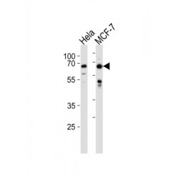 Forkhead Box Protein O3 (FOXO3) Antibody