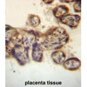 Protein Tyrosine Phosphatase, Non Receptor Type 2 (PTPN2) Antibody