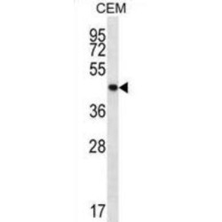 Protein Tyrosine Phosphatase, Non Receptor Type 2 (PTPN2) Antibody