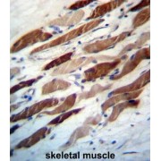 WD Repeat Domain Phosphoinositide-Interacting Protein 2 (WIPI2) Antibody