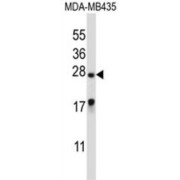 Male-Enhanced Antigen 1 (MEA1) Antibody