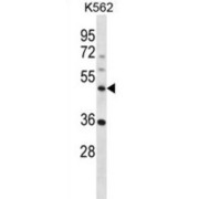 Notchless Homolog 1 (NLE1) Antibody