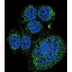 Serine Protease HTRA1 (HTRA1) Antibody