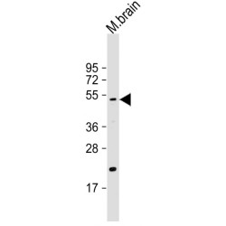 Serine Protease HTRA1 (HTRA1) Antibody