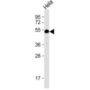 WB analysis of HeLa whole cell lysates (20 µg), using HTRA1 Antibody (1/1000 dilution) and HRP-conjugated Goat anti-Rabbit IgG (H+L) secondary antibody (1/10000 dilution). Predicted band size: 51 kDa. Blocking/Dilution buffer: 5% NFDM/TBST.