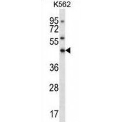 ELAV Like RNA Binding Protein 3 (ELAVL3) Antibody